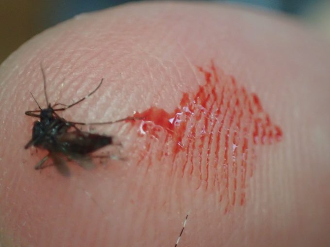 血を吸ったヤブ蚊（ヒトスジシマカ）を駆除した直後の指