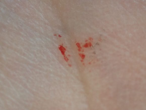 一撃で蚊を仕留めた手の平に残された赤い血痕