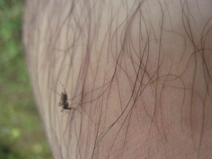 汗で濡れて足毛がべったり箇所の肌から血を吸うヤブ蚊・ヒトスジシマカ