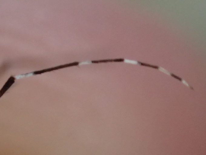 白と黒の交互の模様が特徴のヤブ蚊・ヒトスジシマカの脚