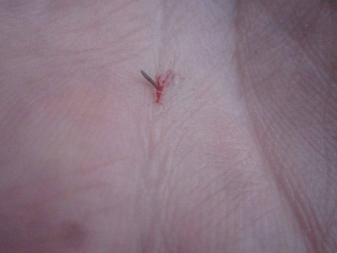 叩いた手の平には吸われた自分の血と駆除した蚊の残骸が張り付いていた