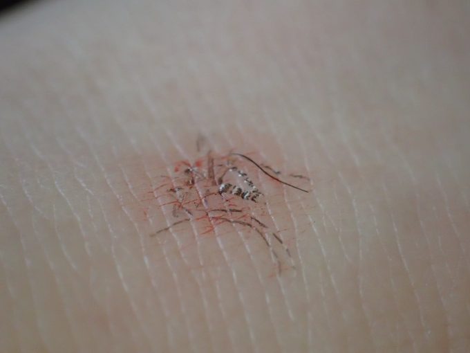 蚊を押し潰した後に肌に残った血と黒い鱗粉のカス