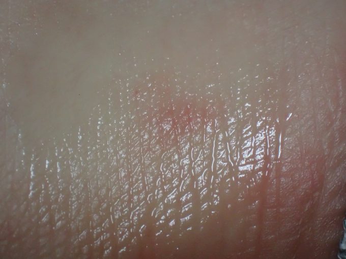 液体ムヒを塗った虫さされ患部の接写画像