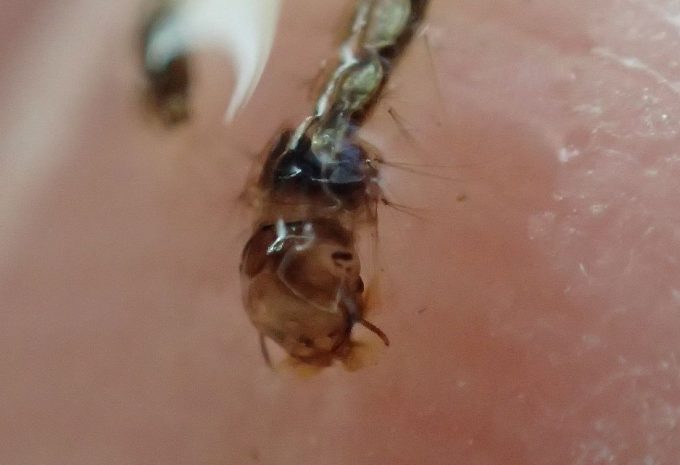 害虫”蚊”の幼虫・赤ちゃんボウフラ